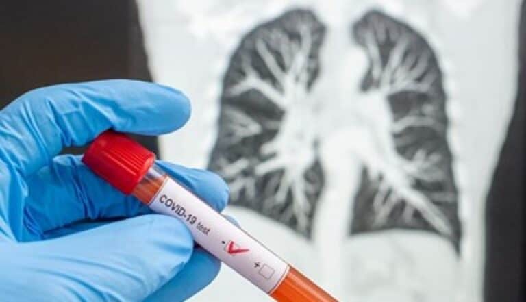 COVID-19 em Portugal. 2.995 casos confirmados e mais 10 mortes