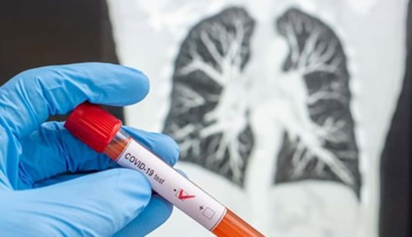 COVID-19 em Portugal. 2.995 casos confirmados e mais 10 mortes