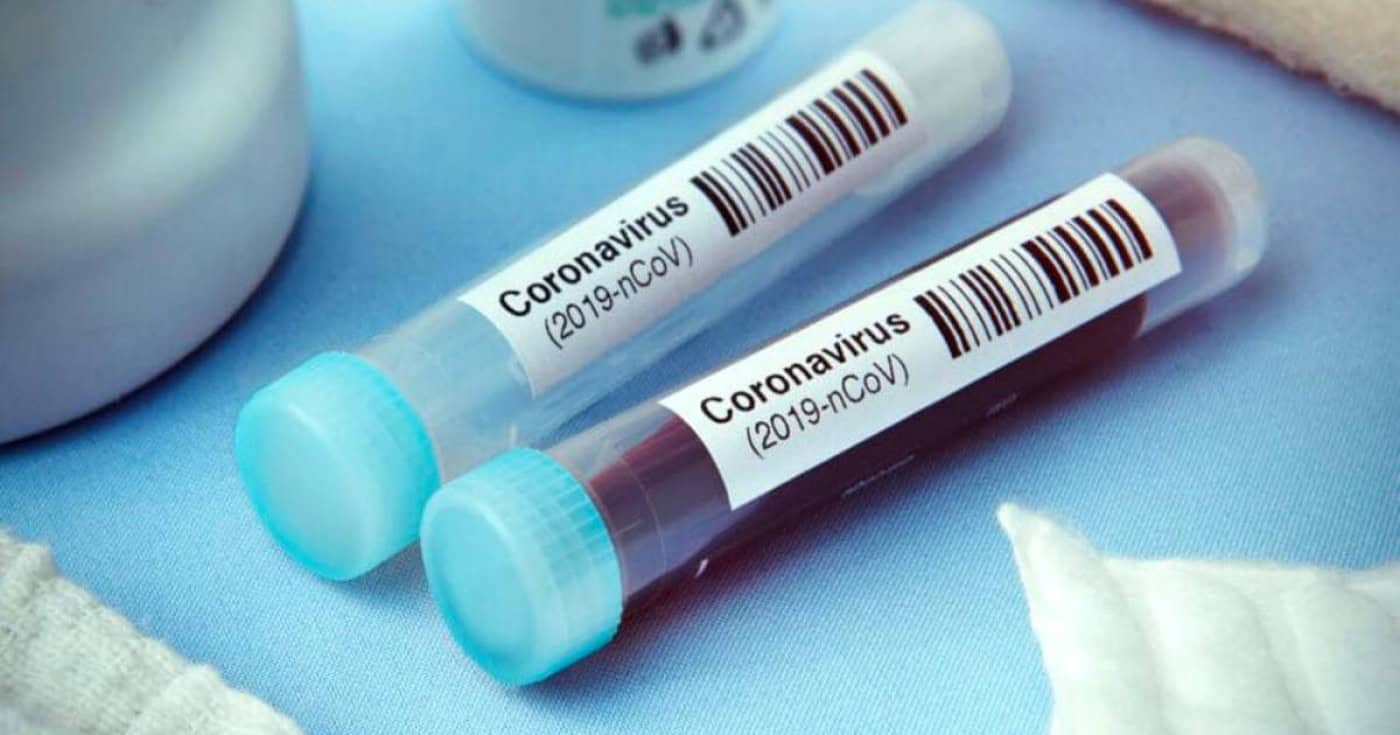 Distrito de Braga com 1573 infectados