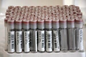 Quatro infectados entre 1700 utentes e funcionários de lares de Famalicão