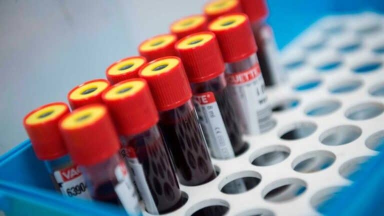 Volta a descer número diário de mortes por Covid-19 em Espanha