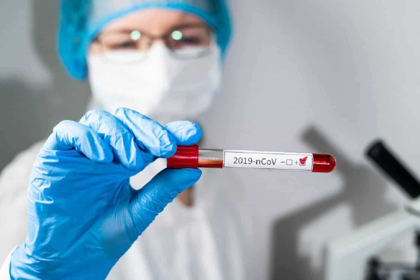 Número de mortes e de novos casos diminuem