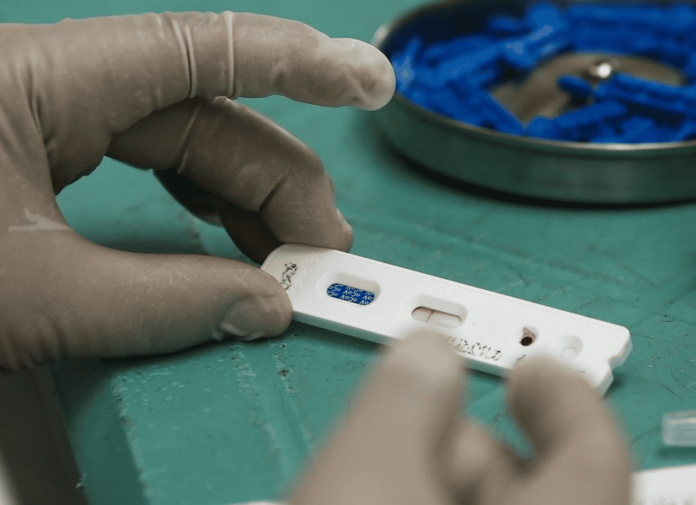 Lote de testes serológicos rápidos vai ser recolhido após "falsos negativos"