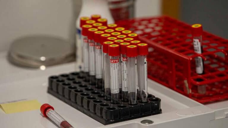 Julho foi o mês com mais testes à Covid-19 em Portugal