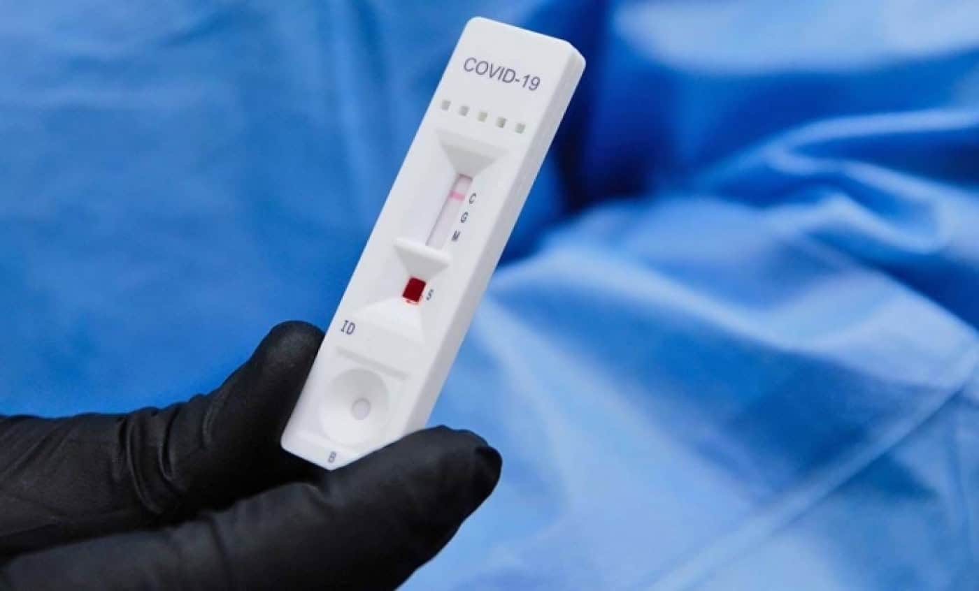 Estudo sobre prevalência da infecção arranca com recrutamento de 12 mil voluntários