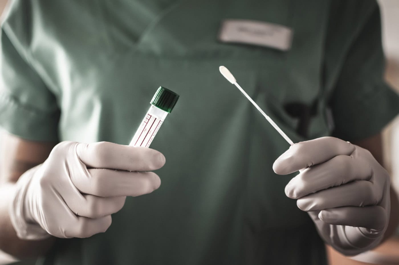 Capacidade do SNS vai aumentar para 21 mil testes por dia