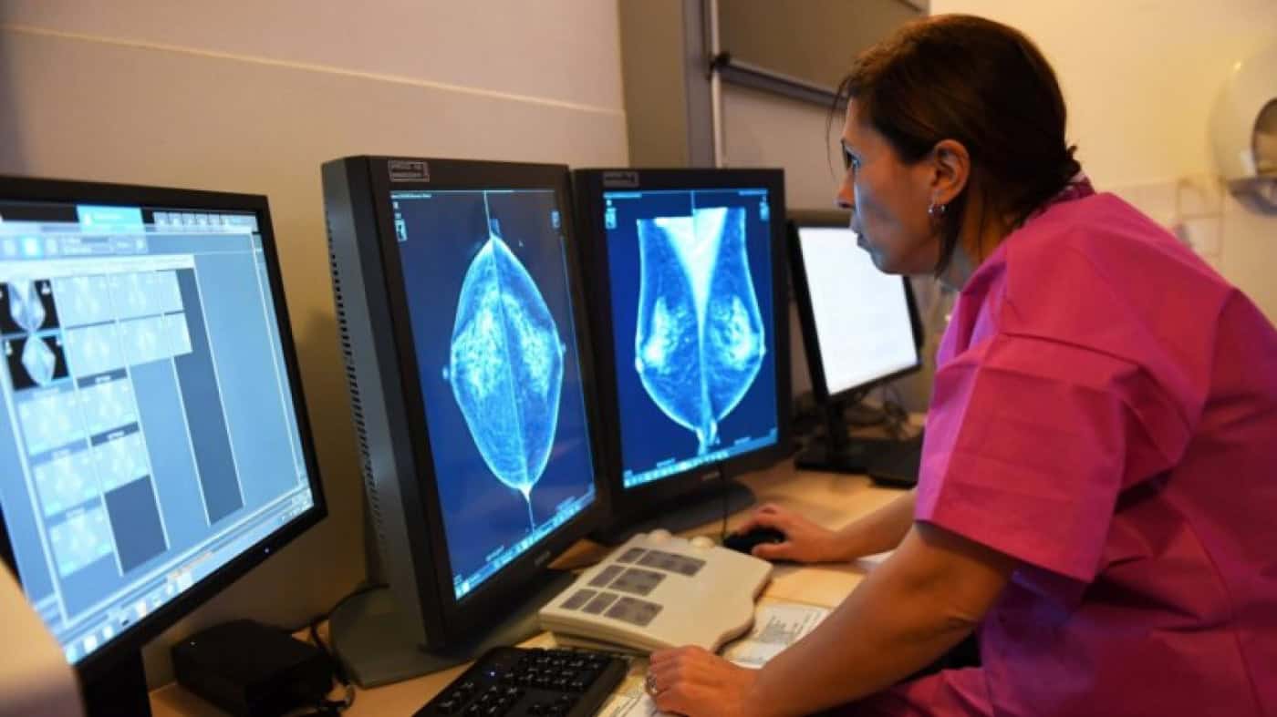 Mais de 100 mil mulheres do Norte sem rastreio ao cancro da mama - Liga