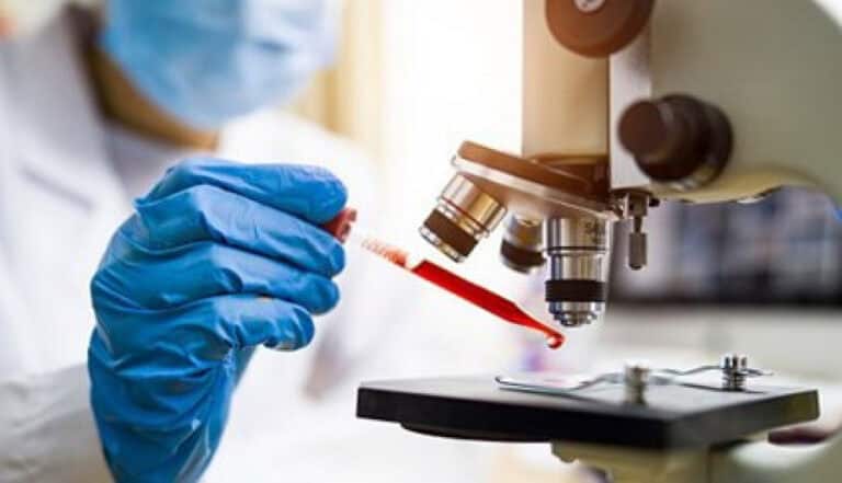 Teste da Unilabs permite diferenciar novo coronavírus de outras infecções respiratórias