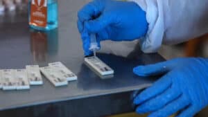 Testes rápidos devem ser aplicados em surtos em escolas ou lares&nbsp;