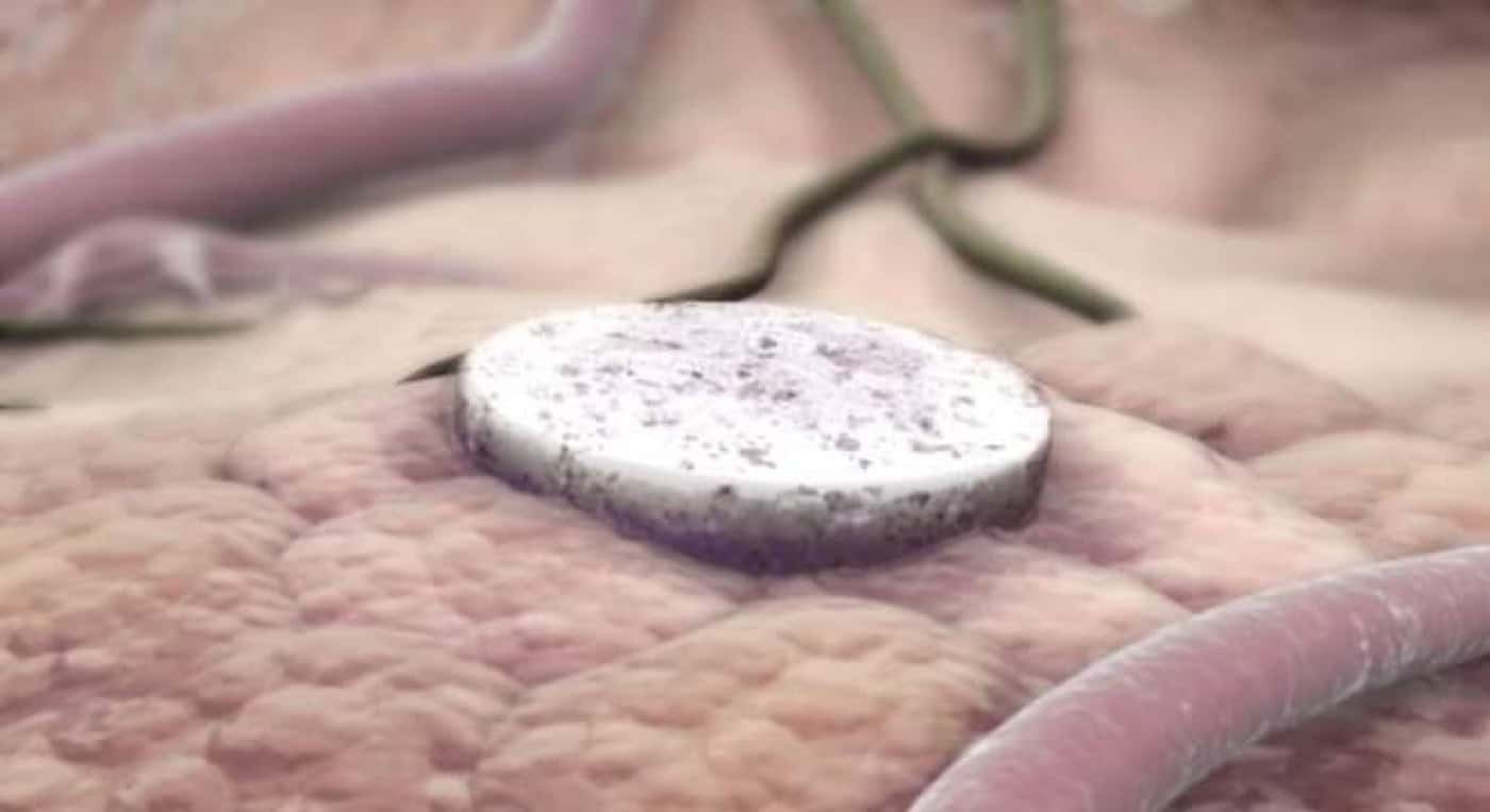 Harvard's Wyss Institute investiga método que reduz&nbsp;o crescimento tumoral