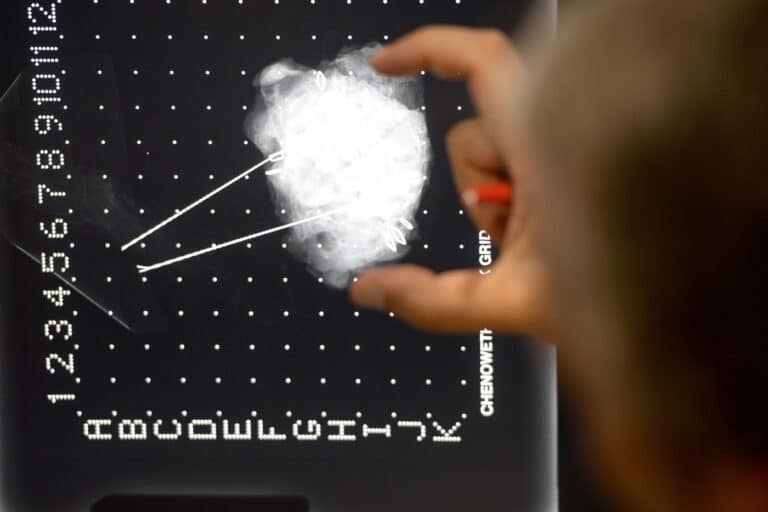Menos meio milhão de pessoas convocadas para rastreios oncológicos