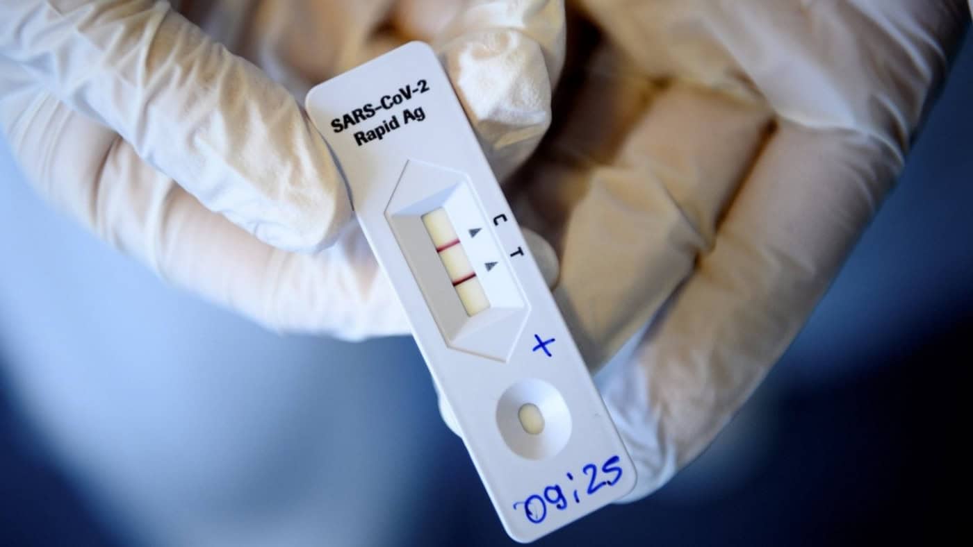 Portugal com 158.534 casos e 292 mortes por Covid-19 entre 31 de maio e 06 de junho