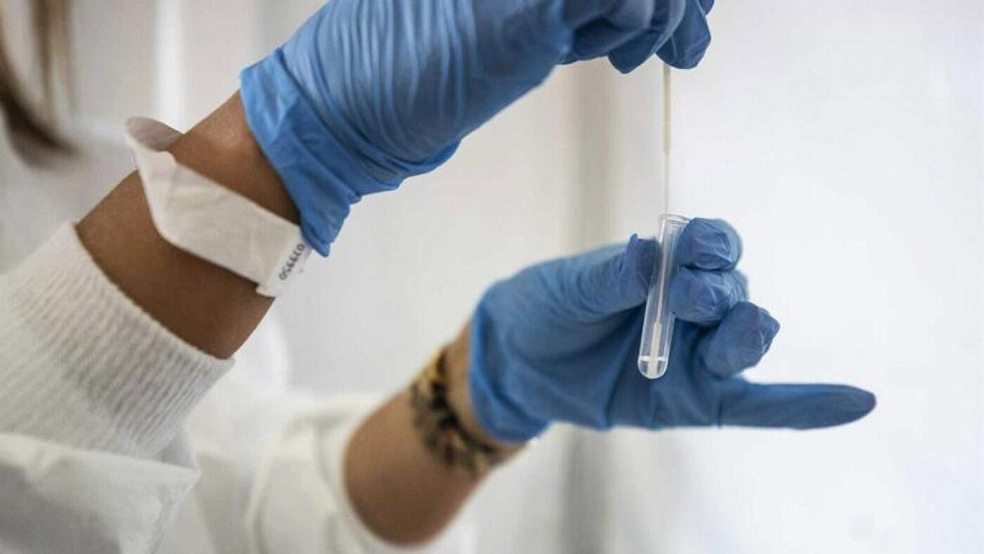 Governo estende até ao final de agosto comparticipação de testes à Covid-19