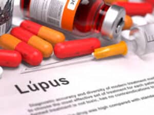 Tratamento com células CAR-T traz nova esperança a doentes com lúpus