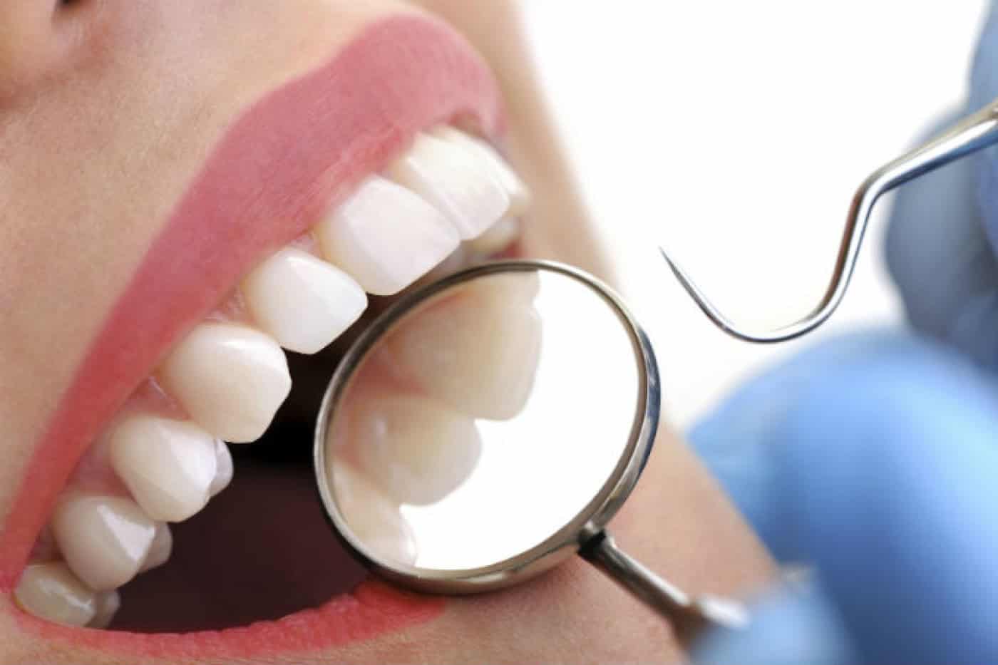 Metade dos portugueses não vai ao dentista porque não tem dinheiro&nbsp;