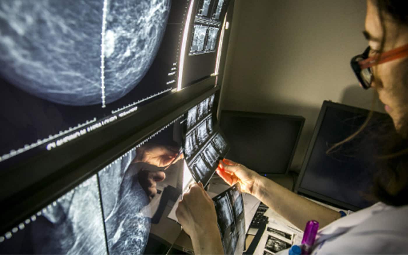 Aumentaram 80% os novos casos de cancro abaixo dos 50 anos desde 1990