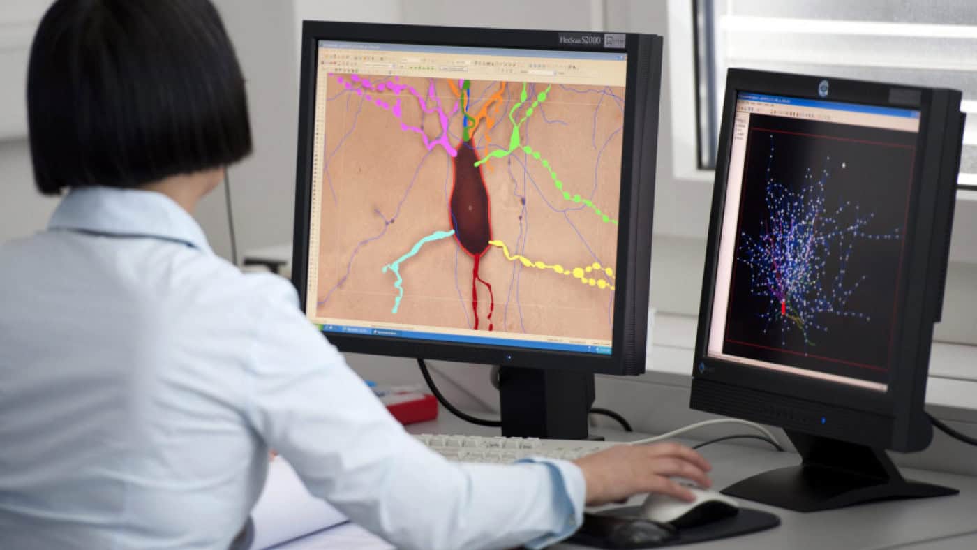 Prémio Bial de Biomedicina 2023 distingue estudo sobre tumor cerebral agressivo