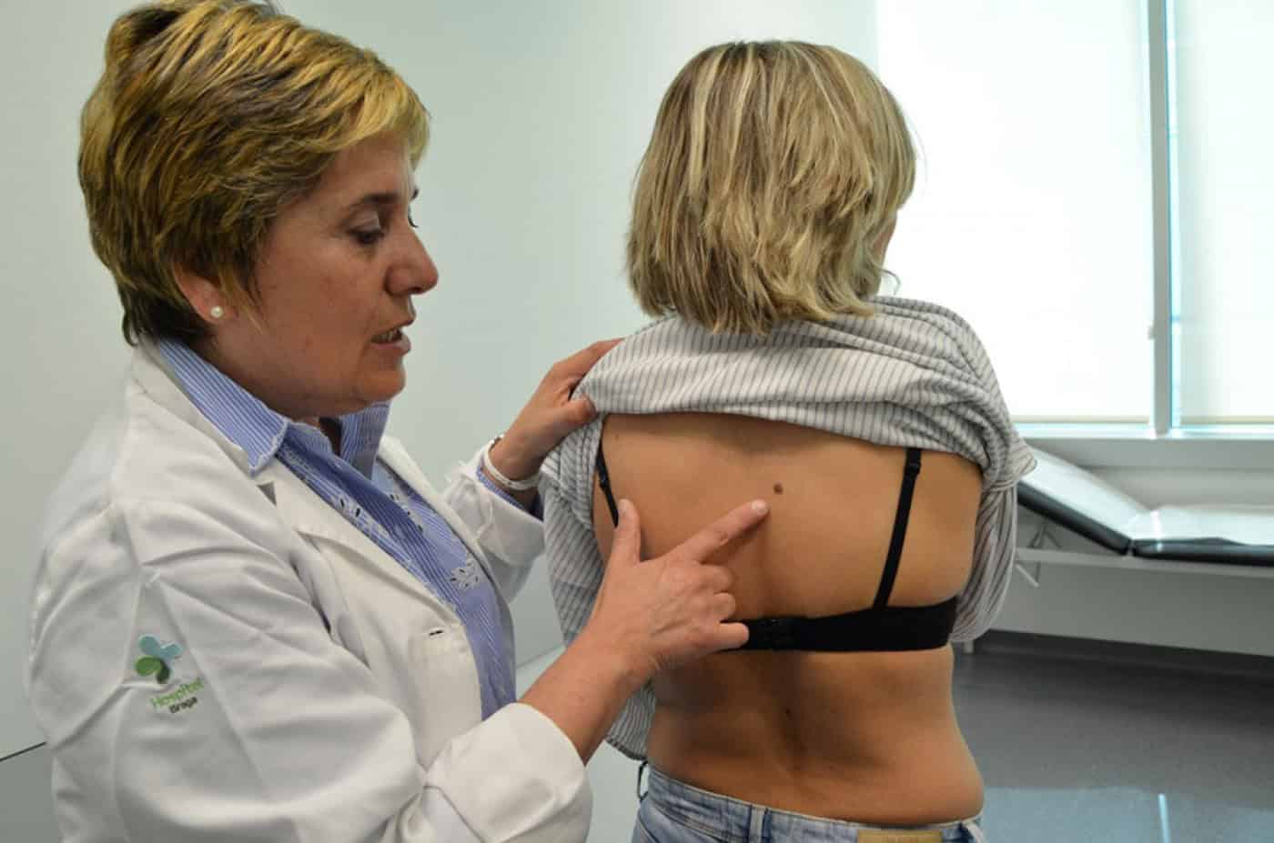 Cancro da pele está aumentar entre os jovens