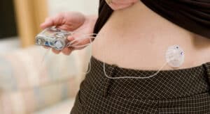 Diabéticos vão poder adquirir bombas de insulina automáticas nas farmácias