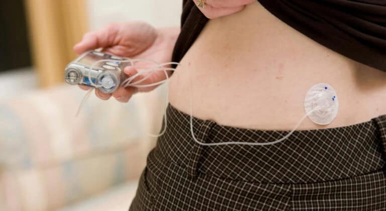 Diabéticos vão poder adquirir bombas de insulina automáticas nas farmácias
