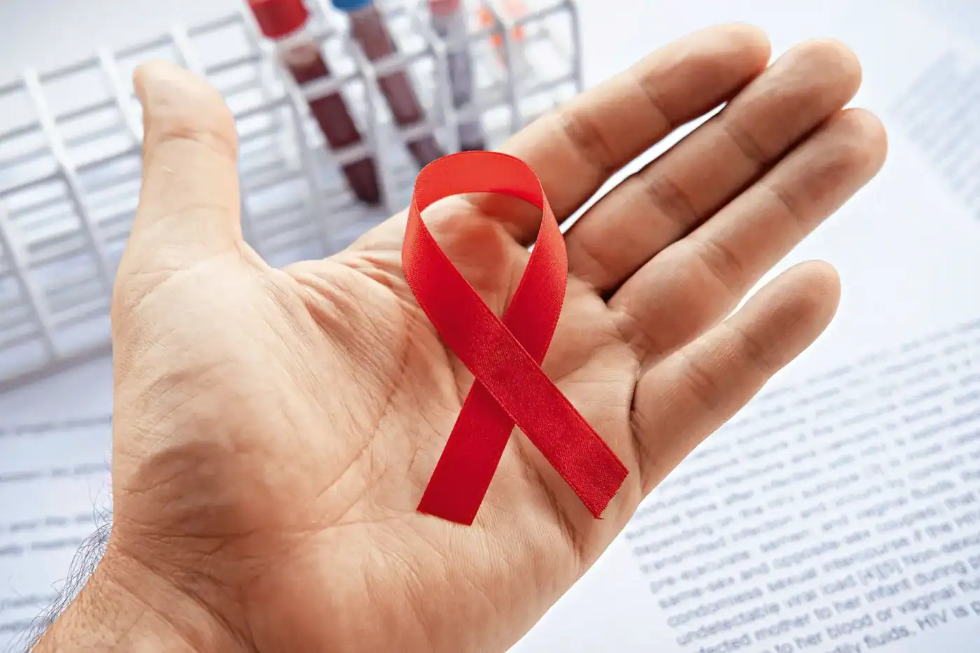 Portugal registou 120 novos casos de VIH em 2023