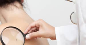 ULS Braga promove rastreios gratuitos de cancro de pele